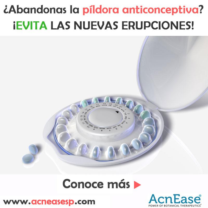Quiero dejar de tomar la píldora anticonceptiva, ¿me ayudará AcnEase a disminuir la aparición de nuevas erupciones de acné?