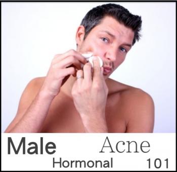 Male Hormonal Acne 101.  Part I: Why Men Get Acne