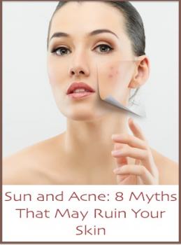 Sun and Acne: 8 Myths That May Ruin Your Skin